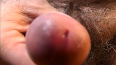 mi pene